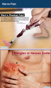 Nerve Pain screenshot 5