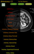 Radiology CT Anatomy screenshot 6