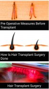 Hair loss and treatment( trans screenshot 4