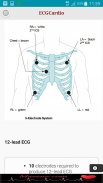 ECGCardio screenshot 3