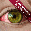 Home Remedies For Pink Eye - Conjunctivitis Icon