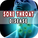 Sore Throat: Causes, Diagnosis, and Management