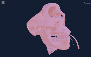 CT Scan Viewer 3D screenshot 0