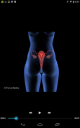 Gynecology-Animated Dictionary screenshot 6