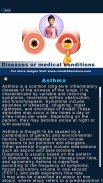 Respiratory System Anatomy Pro. screenshot 15