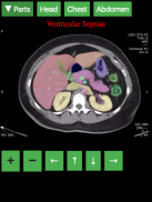 Radiology CT Anatomy screenshot 4