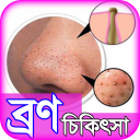 bron dur korar upay or tips ~ ব্রণ দূর করার উপায়