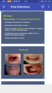 Basics of All Skin Diseases screenshot 6