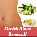 STRETCH MARK REMOVAL