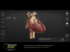 INSIGHT HEART screenshot 11