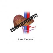 Liver Cirrhosis screenshot 3