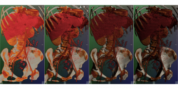 DroidRender - 3D DICOM viewer screenshot 15