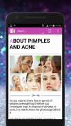 Skin Treatment - Get Rid Of Acne And Pimples Natur screenshot 1