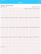 Mini ECG Aide screenshot 2