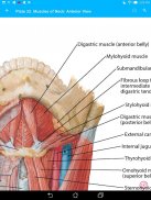 Anatomy Atlas, USMLE, Clinical screenshot 13