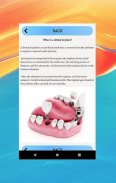 Dental Implants Guide screenshot 1