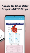 ECG EKG Interpretation Mastery screenshot 13