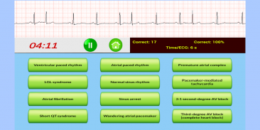 ECG Rhythm Quiz screenshot 2