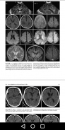 Imaging Brain, Skull & Craniocervical Vasculature screenshot 4