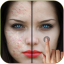 Pimples removing photo editing app