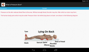 Pressure Ulcer screenshot 18