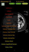 Radiology CT Anatomy screenshot 2