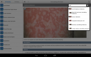 Dermatology DDx screenshot 10