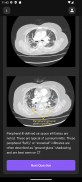 Basic Radiology screenshot 6