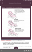 MSD Manual Guide to Obstetrics screenshot 0