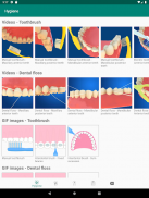 Dental diagnosis & patient education aid - Dentalk screenshot 2