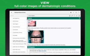 5-Minute Clinical Consult screenshot 9