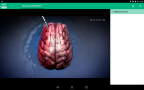 AESCULAP Neuroendoscopy screenshot 1