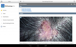 Dermatology DDx screenshot 9
