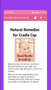 Natural Remedies For Cradle Cap screenshot 1