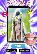 Braces Teeth  Photo Editor screenshot 2