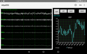 AttysEEG screenshot 9