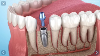 Dental 3D Illustrations screenshot 11