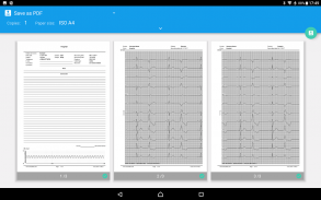 DiaCard - ECG Recorder screenshot 10