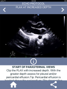 LEARN FULL ECHO TTE PROTOCOL screenshot 2