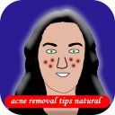acne removal tips natural Icon