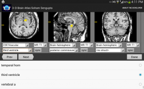 3-D brain Atlas screenshot 4