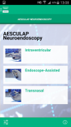 AESCULAP Neuroendoscopy screenshot 6