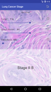 Lung Cancer Stage screenshot 1