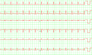 Mobile patient monitoring screenshot 2