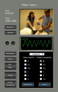 心电图节律和脉搏 screenshot 13