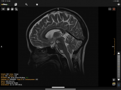 mRay - DICOM Viewer screenshot 10