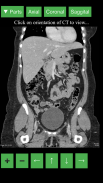 Radiology CT Viewer screenshot 4