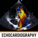 Echocardiography