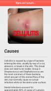 Cellulitis Infection screenshot 7