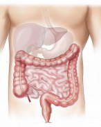 Colon Cancer guide screenshot 0